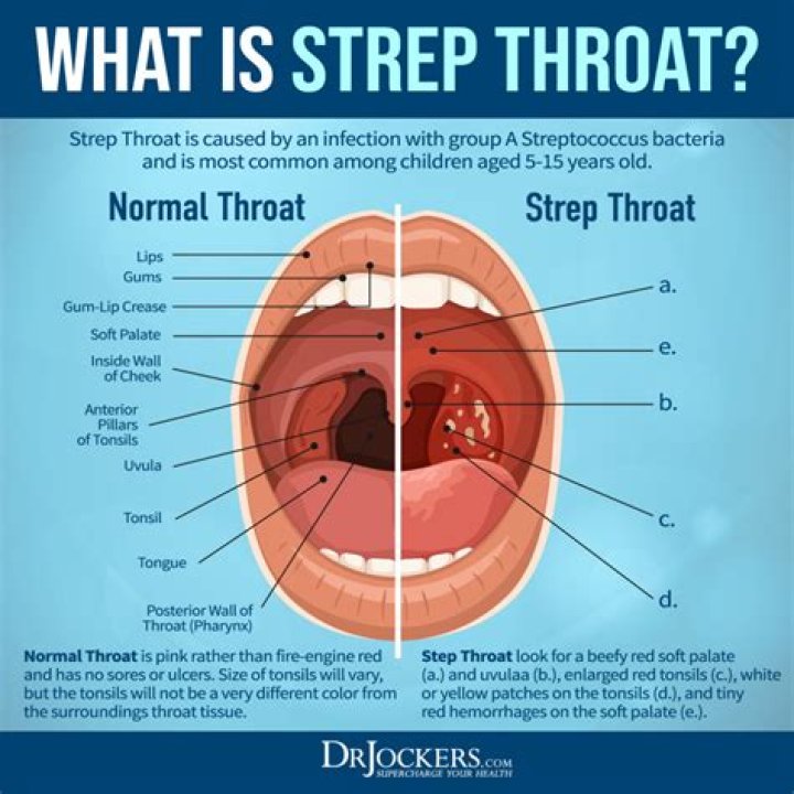 What does it mean when you have strep in your blood?